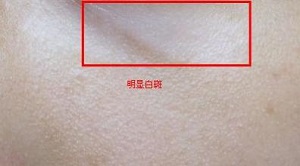 °×ñ°·çÓÐÄÄÐ©ÌØÕ÷