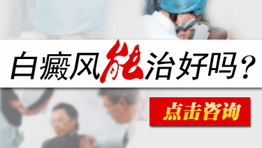 白癜风怎么治好