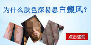 身上为什么会出现白斑呢