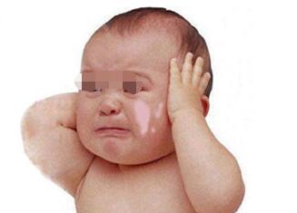 ±¦±¦Í·ÉϳöÏÖ°×ñ°·çÔõô´¦Àí