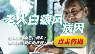 老年患上白癜风的原因是什么