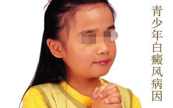 青少年身上为什么会患上白癜风呢