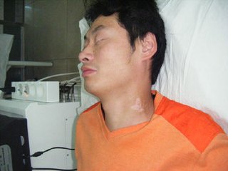 男性得白癜风都有什么原因