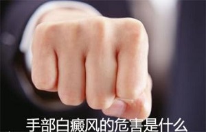 外伤会诱发手部白癜风吗