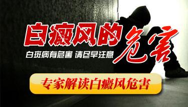 患上白癜风会有什么伤害