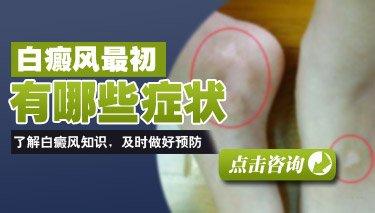 白癜风都有哪些症状表现