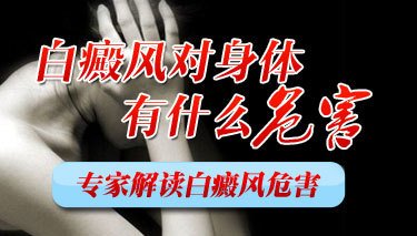 白癜风有哪些心理危害