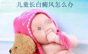 婴儿为什么会患上白癜风呢