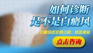 诊断白癜风的基本方法都有哪些