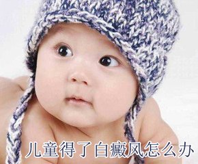 孩子有白癜风会影响发育吗?