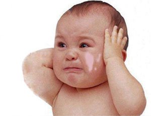 冬季婴儿白斑患者该如何护肤