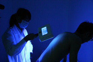 伍德灯检查白癜风 怎么治疗