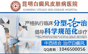 昆明白癜风是什么症状