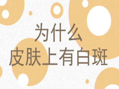 昆明白斑的病因你了解吗