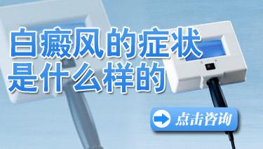 云南白癜风初期症状有哪些