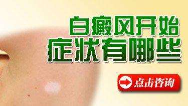 云南白癜风初期症状是什么