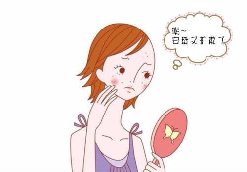 面部白癜风的护理要注意哪些